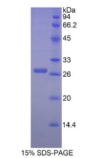 Mouse EDA / Ectodysplasin A Protein (Recombinant His)