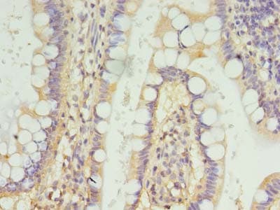 FSCB Antibody