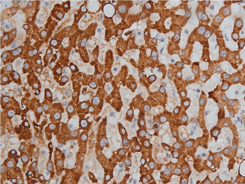 Polyclonal Rabbit anti-Human HDAC3 Antibody (phospho-Ser424, IHC, IF, WB)