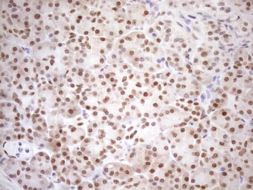 Monoclonal Mouse anti-Human MGMT Antibody (clone OTI2F10, IHC, WB)