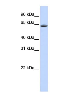 SLC33A1 Antibody (aa216-265)