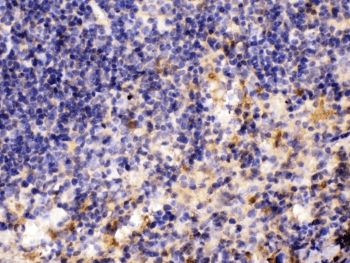 Polyclonal Rabbit anti-Human MMP11 Antibody (IHC, WB)