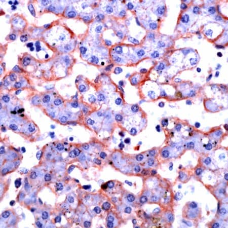 Polyclonal Rabbit anti-Human ANXA6/Annexin A6/Annexin VI Antibody (IHC, WB)