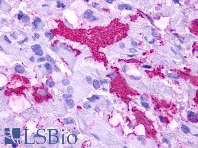 PathPlus™ GPR84 Antibody (Extracellular Domain)