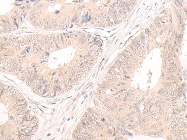 LCMT2 / YW4 Antibody