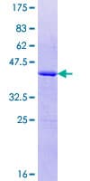 Human PPP3R2 Protein (Recombinant GST)