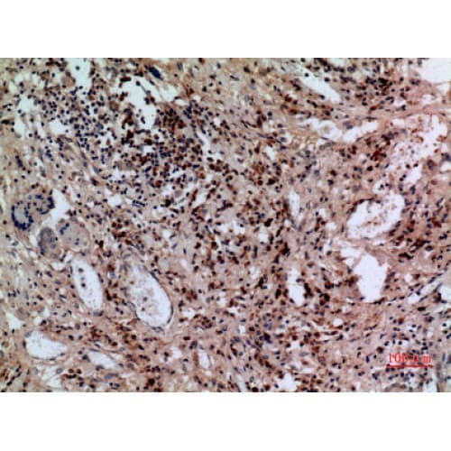 Polyclonal Rabbit anti-Human SLC10A1 / NTCP Antibody (281-330 aa, C-terminal, IHC, WB)