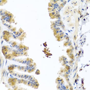 YKL39 / CHI3L2 Antibody