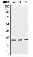 CRP / C-Reactive Protein Antibody (Internal)