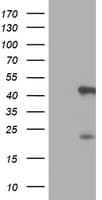 SERPINB6 / PI-6 Antibody (clone OTI2F8)