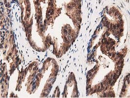 GSTT2 Antibody (clone OTI9A1)