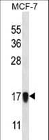 NDUFA13 / GRIM19 Antibody (aa1-29)