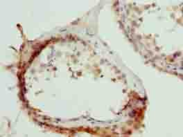 TRIM55 / MURF2 Antibody