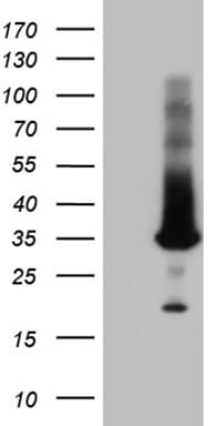 RAB23 Antibody (aa1-234, clone OTI1A3)