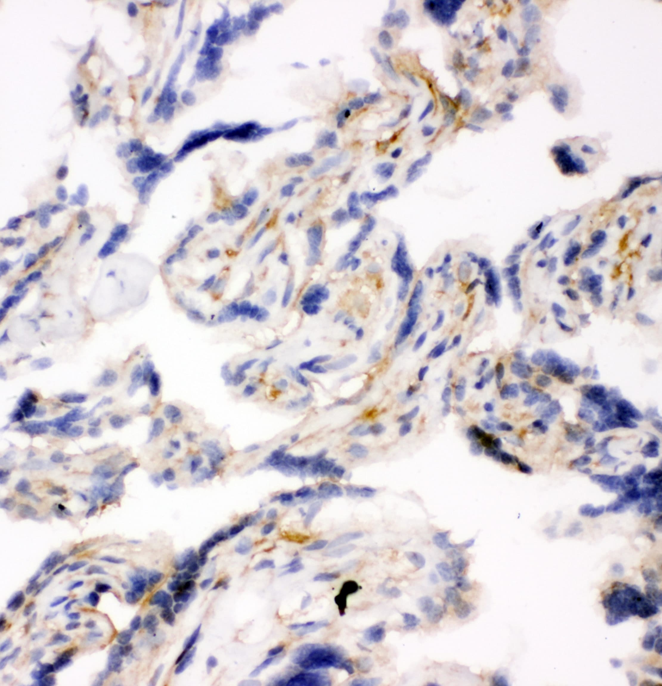 SNAP23 / SNAP-23 Antibody (aa192-211)