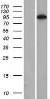 NOM1 Protein (Over-Expression Lysate Myc-DDK (Flag))