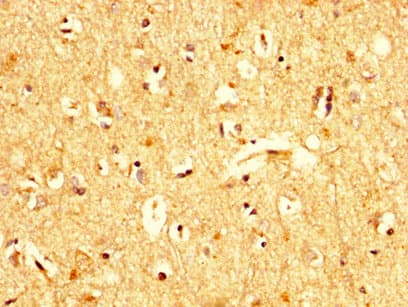 UBA52 Antibody
