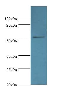 EPHX1 / Epoxide Hydrolase 1 Antibody (aa1-455)