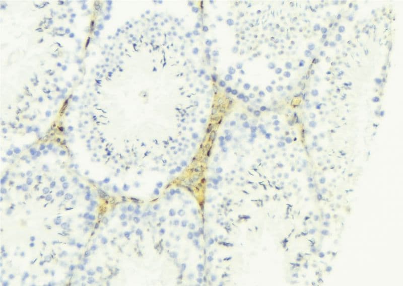 LAMA4 / Laminin Alpha 4 Antibody