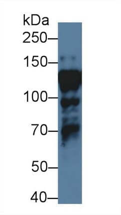 NF90 / ILF3 Antibody (aa672-891, Biotin)