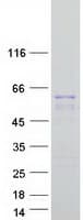 Human KRT12 / CK12 / Cytokeratin 12 Protein (Recombinant Myc-DDK (Flag))