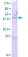 Human ZNF771 Protein (Recombinant GST)