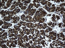 HSD17B8 / RING2 Antibody (aa57-261, clone OTI6H2, Carrier-free)