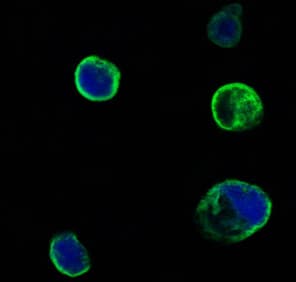 MUSK Antibody (clone 10A4)