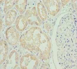 Polyclonal Rabbit anti-Human SLC39A4 / ZIP4 Antibody (IHC, WB)