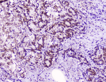 HMGN2 Antibody