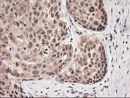 MGLL / Monoacylglycerol Lipase Antibody (clone OTI4D1)