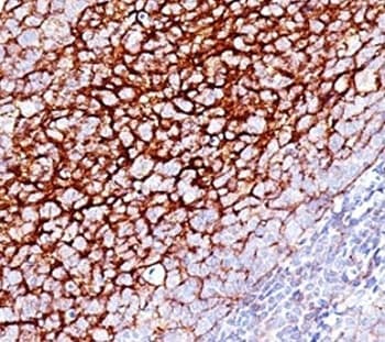 CR1 / CD35 Antibody (clone SPM554, Azide-free, BSA-free)