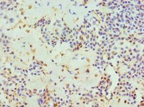 TIP30 / HTATIP2 Antibody (aa1-230)