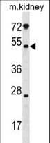 GALNT13 Antibody (aa252-281)