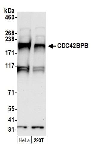 CDC42BPB / MRCKB Antibody (aa750-800)
