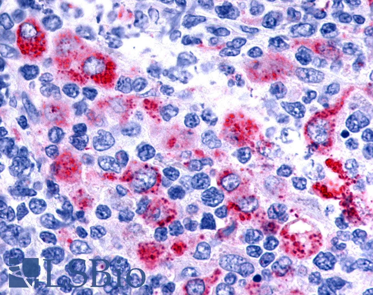 PathPlus™ Polyclonal Rabbit anti-Human ADGRE3 / EMR3 Antibody (N-Terminus, IHC)