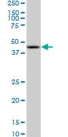 NODAL Antibody (clone 5C3)