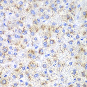 IHC-plus™ HAO1 Antibody