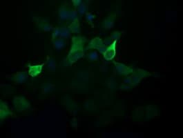 PIK3R5 Antibody (clone OTI5B1)