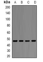 PathPlus™ Polyclonal Rabbit anti-Human ENO1 / Alpha Enolase Antibody (IHC, IF, WB)