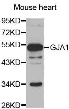 Polyclonal Rabbit anti-Human GJA1 / CX43 / Connexin 43 Antibody (WB)