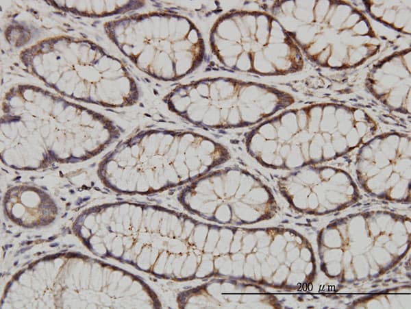 CIB1 / KIP Antibody (clone 4D2-3A8)