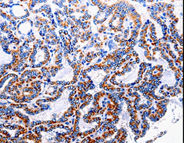 Polyclonal Rabbit anti-Human NFKB1 / NF-Kappa-B Antibody (IHC)