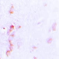 Polyclonal Rabbit anti-Human CDCA3 Antibody (C-Terminus, IHC, IF, WB)