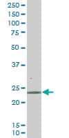 RAB43 Antibody (clone 5G4)