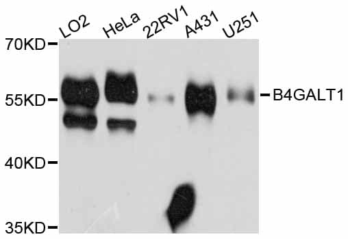 IHC-plus™ B4GALT1 Antibody