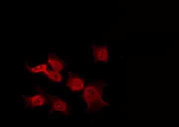 Polyclonal Rabbit anti-Human PIK3R1 / p85 Alpha Antibody (phospho-Tyr199,phospho-Tyr467, IF, WB)