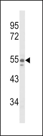 NAMPT / Visfatin Antibody (aa400-426)