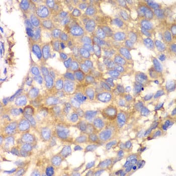 Polyclonal Rabbit anti-Human CAPNS1 / CAPN4 Antibody (IHC, WB)