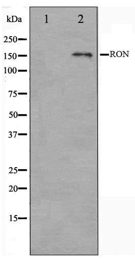 MST1R / RON Antibody